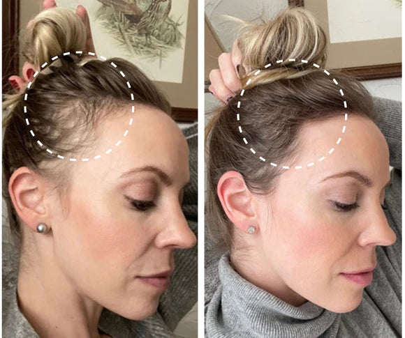 Multi-Function Scalp Massage Comb